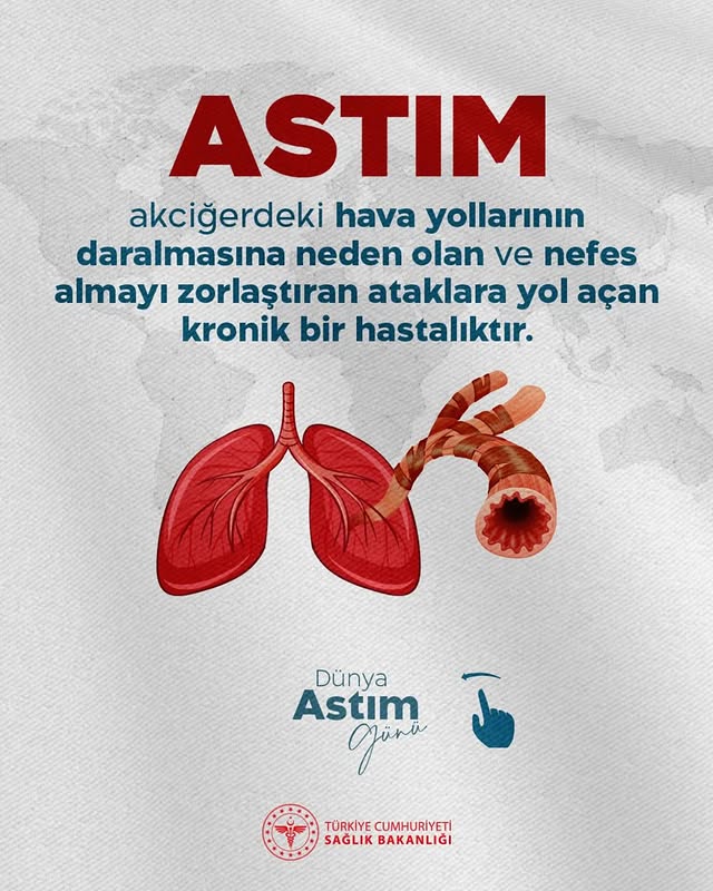 Antalya'da Astım Farkındalık Etkinlikleri Düzenlendi